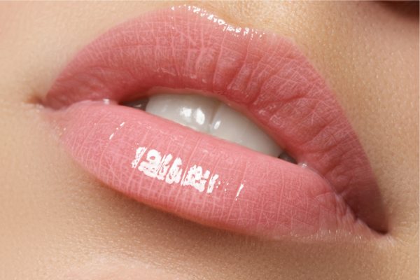 LIP FILLERS IN NEWCASTLE LIP FILLERS IN NEWCASTLE