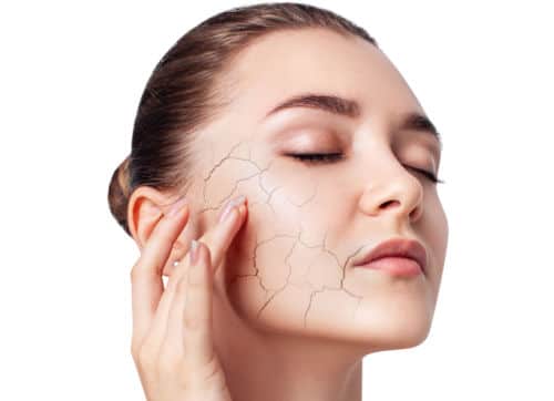 dry skin